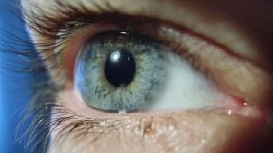 Zdrowe oczy 5 rad dla dobrego wzroku