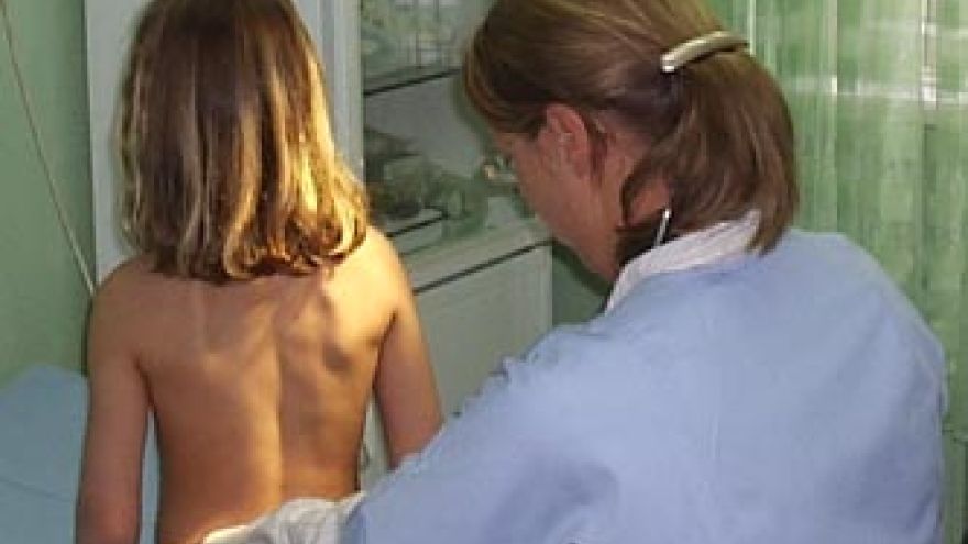 Choroby kręgosłupa Wady postawy u dzieci