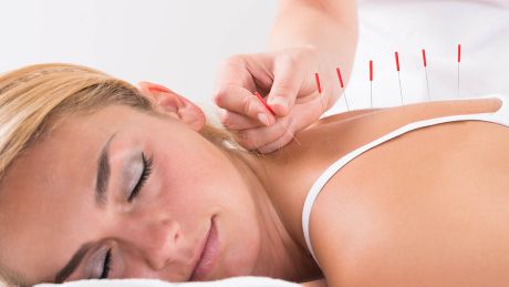 Akupunktura zwalcza przewlekły stres