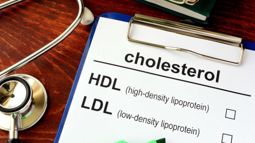 Cholesterol Co to jest cholesterol HDL? Dobry cholesterol, jakiego potrzebujemy
