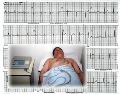 EKG