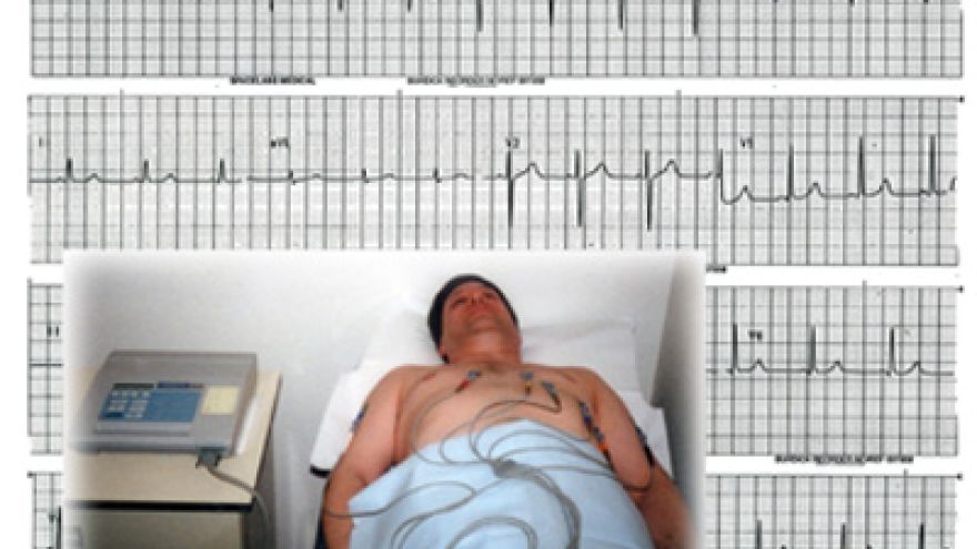 EKG Badanie EKG