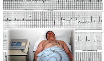 Badanie EKG