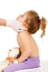 baby-skin-rash