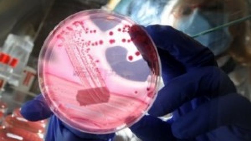 Bakteria EHEC - groźna bakteria