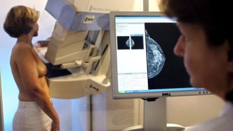 Mammografia ratuje życie!