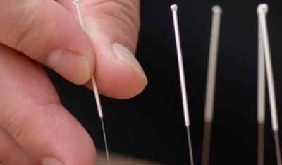 Akupunktura zwalcza przewlekły stres