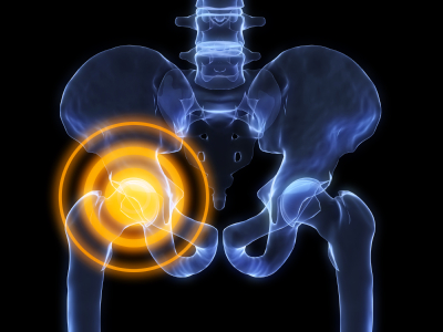 Ortopedska rehabilitacija za ramena, kukove, zglobove, laktove i koljena
