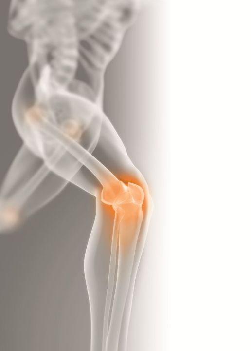 Osteoartroza – ratuj swoje stawy