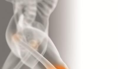 Osteoartroza – ratuj swoje stawy