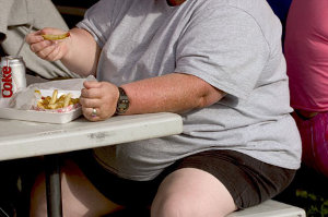 obesity(2)
