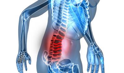 Skąd się biorą bóle kręgosłupa?