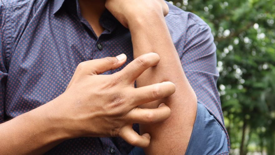 Alergia Wiosenne alergie a dieta: co jeść, a czego unikać, aby złagodzić objawy? Porady żywieniowe dla osób z alergiami sezonowymi