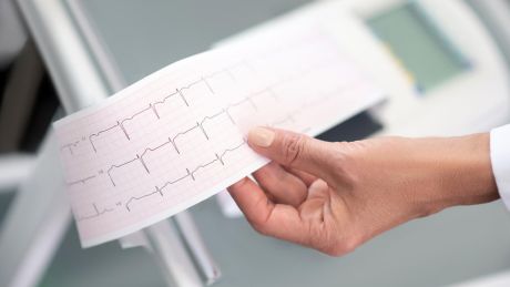 Ile kosztuje i gdzie zrobić EKG w Łodzi?