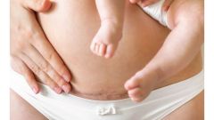 Aktualności Jak zadbać o ciało po porodzie? Porady kosmetologa
