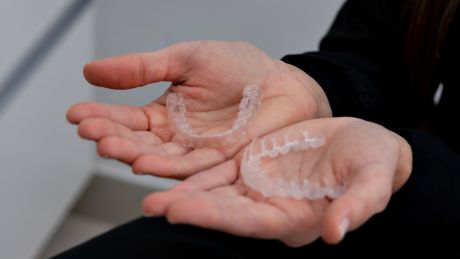 Metalowy czy nakładkowy – jaki aparat wybrać? 