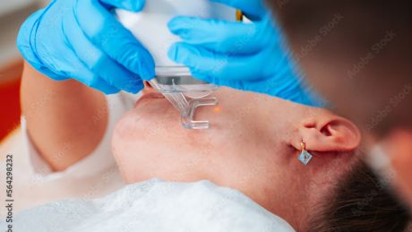 W czym tkwi sekret laserów frakcyjnych