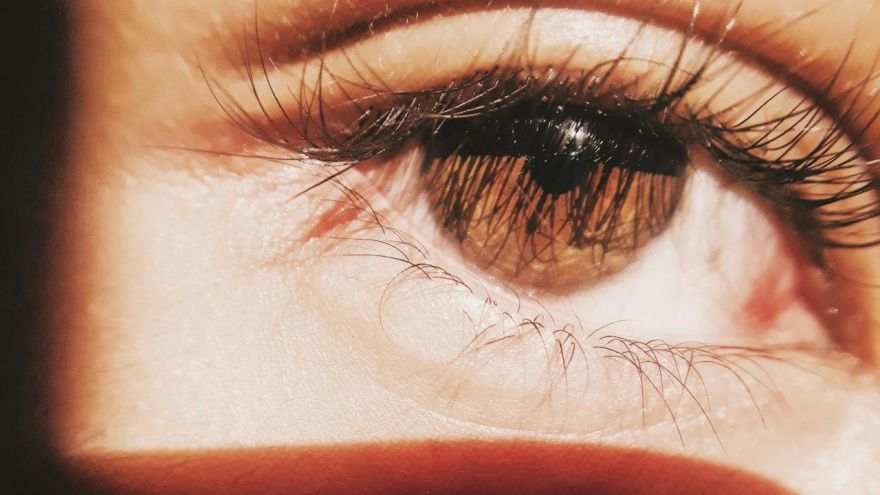 Zdrowie Krew pod spojówką – niepokojący widok, często banalna przyczyna