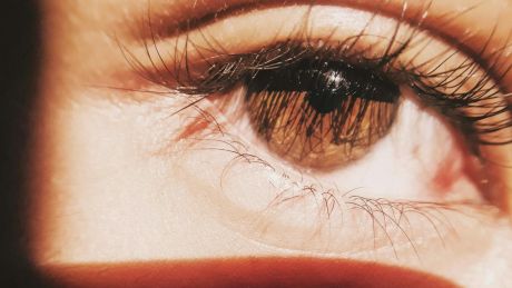 Krew pod spojówką – niepokojący widok, często banalna przyczyna
