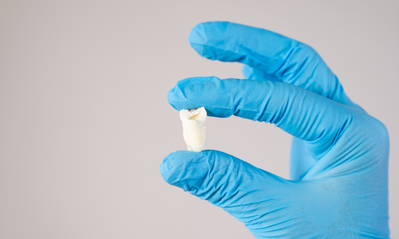 „Ósemki” pod lupą chirurga. Kiedy i dlaczego trzeba je usuwać?