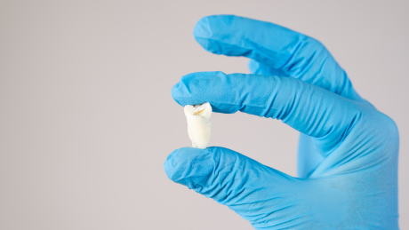 „Ósemki” pod lupą chirurga. Kiedy i dlaczego trzeba je usuwać?